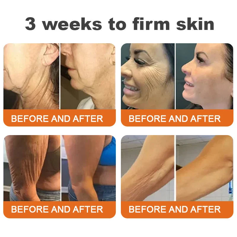 Anti-Aging Stick Solid Applicator Bee Venom & Hyaluronic Acid