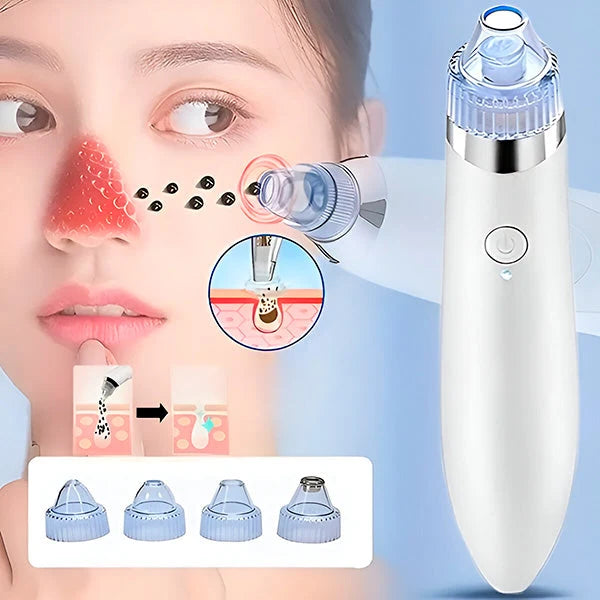 Facial Pore Cleaner Vacuum Suction & Microdermabrasion USB Rechargeable