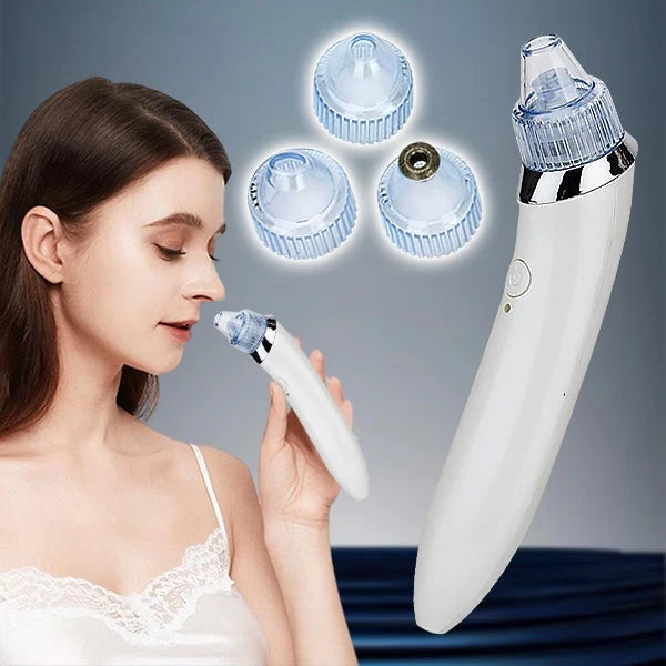 Pore Cleaner 2-In-1 Vacuum & Microdermabrasion USB Rechargeable