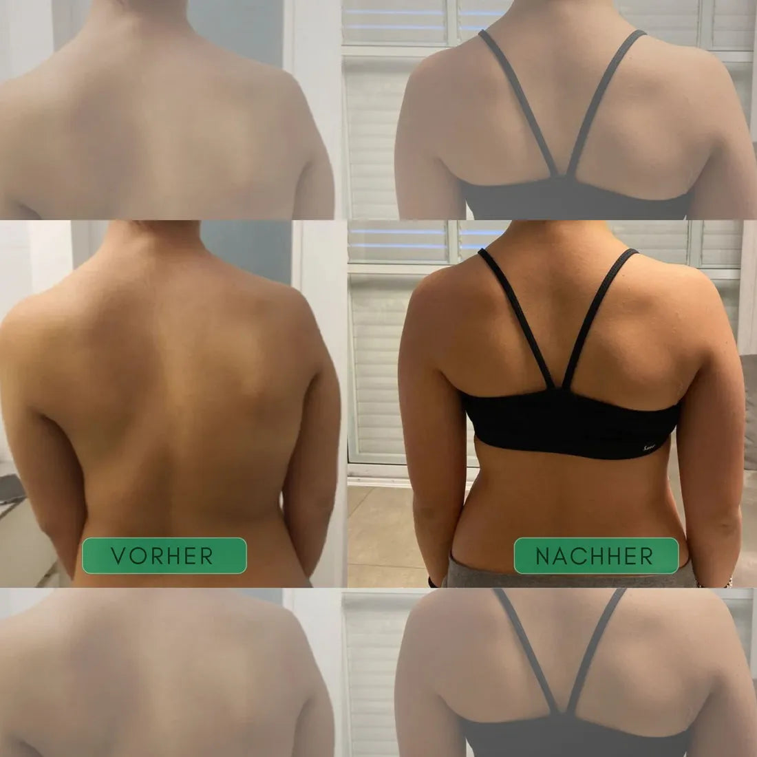 Back & Shoulder Posture Corrector X-Shaped Adjustable Low-Profile