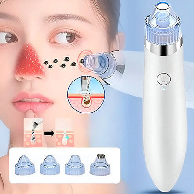 Facial Pore Cleaner Vacuum Suction & Microdermabrasion USB Rechargeable