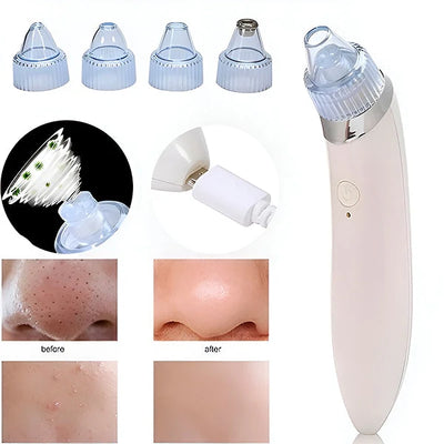 Facial Pore Cleaner Vacuum Suction & Microdermabrasion USB Rechargeable