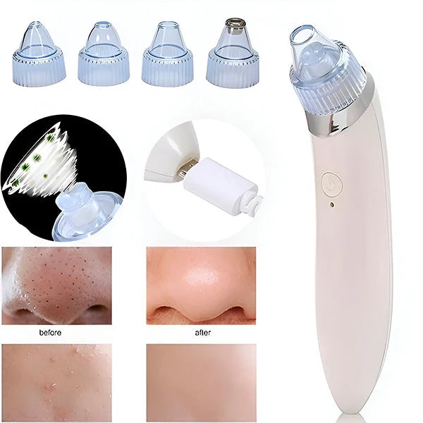Pore Cleaner 2-In-1 Vacuum & Microdermabrasion USB Rechargeable