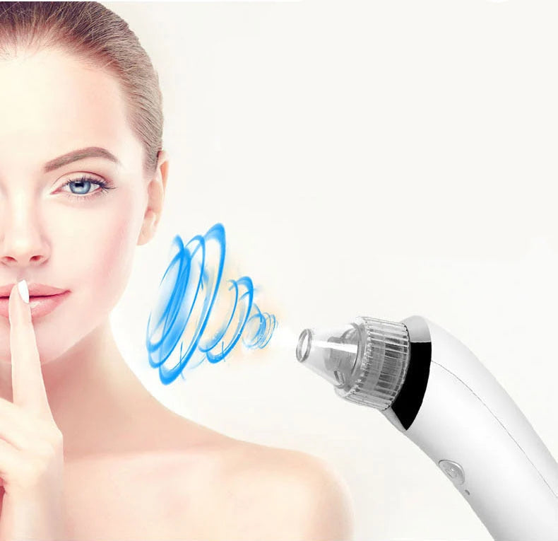 Pore Cleaner 2-In-1 Vacuum & Microdermabrasion USB Rechargeable