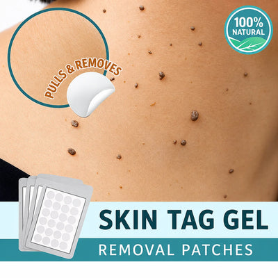 Skin Tag Removal Patches Pain-Free & Non-Invasive Skin-Friendly