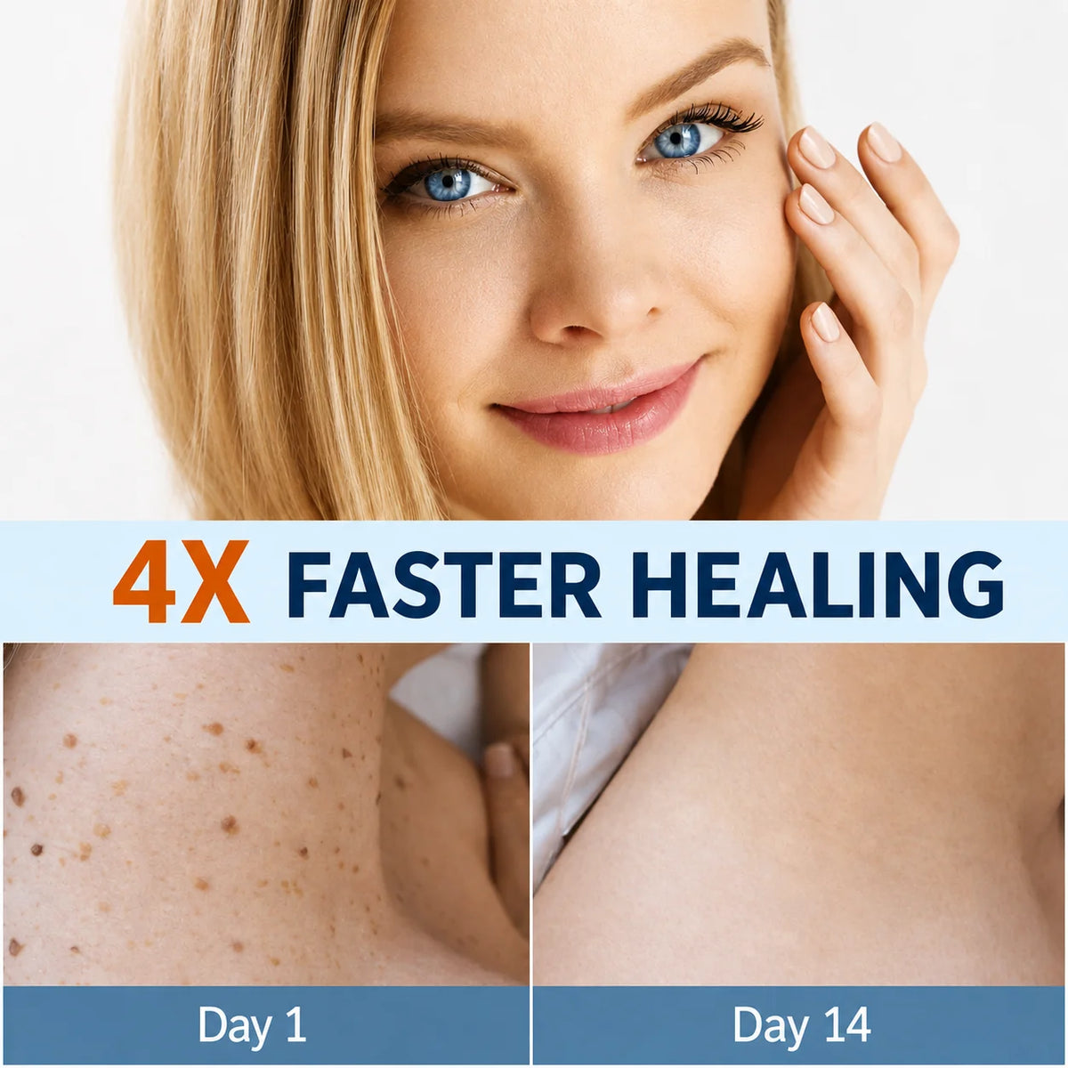 Skin Tag Removal Patches Pain-Free & Non-Invasive Skin-Friendly