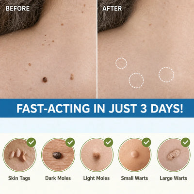 Skin Tag Removal Patches Pain-Free & Non-Invasive Skin-Friendly