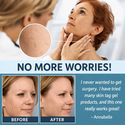 Skin Tag Removal Patches Pain-Free & Non-Invasive Skin-Friendly