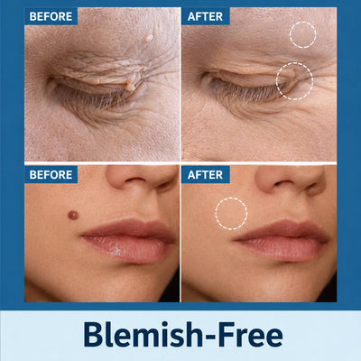 Skin Tag Removal Patches Pain-Free & Non-Invasive Skin-Friendly