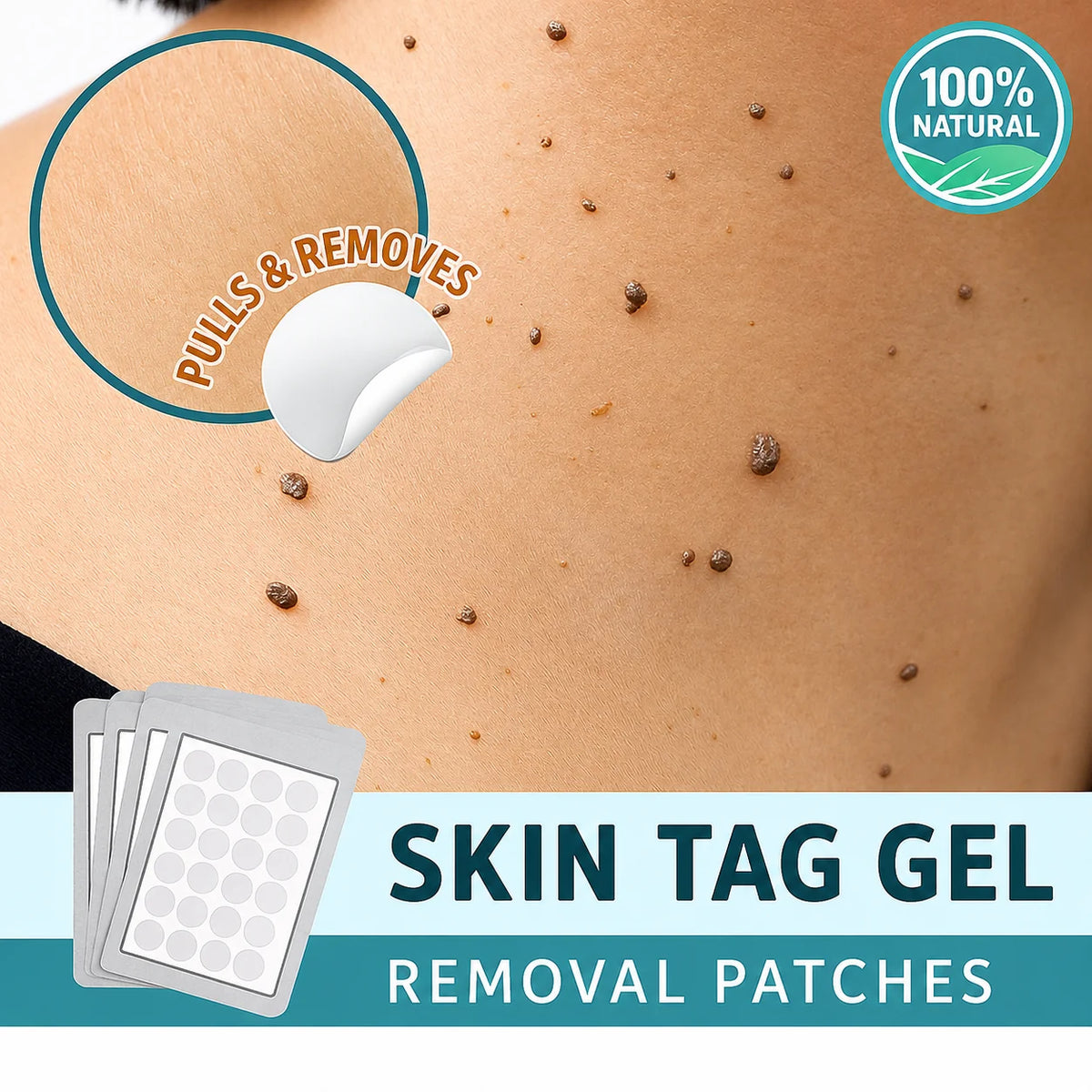 Skin Tag Remover Patches Painless Natural Skin-Friendly