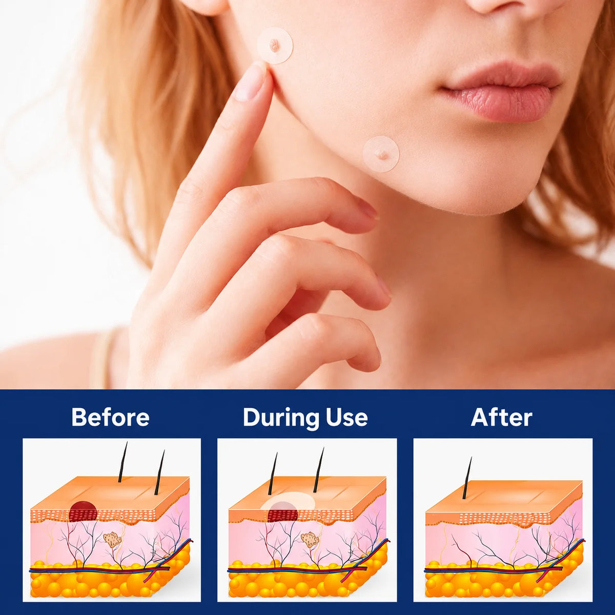Skin Tag Remover Patches Painless Natural Skin-Friendly